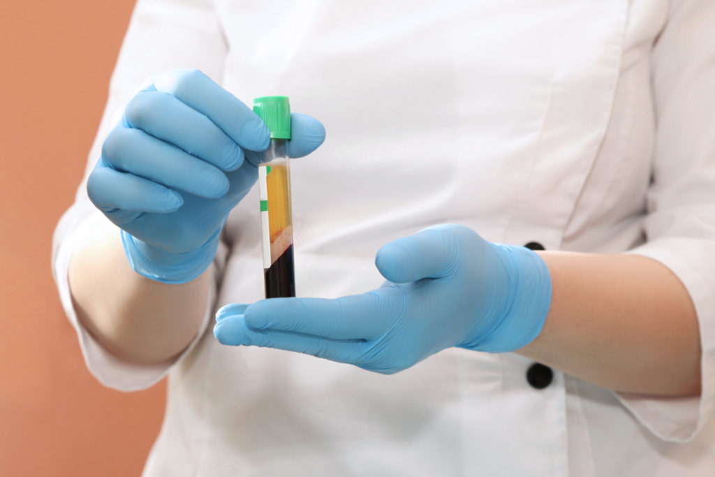 Is Platelet-Rich Plasma Covered by Insurance All Questions Answered
